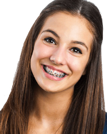 Why Choose Us - Platinum Orthodontics