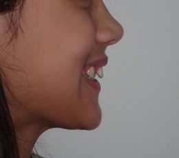 Mouth Profile